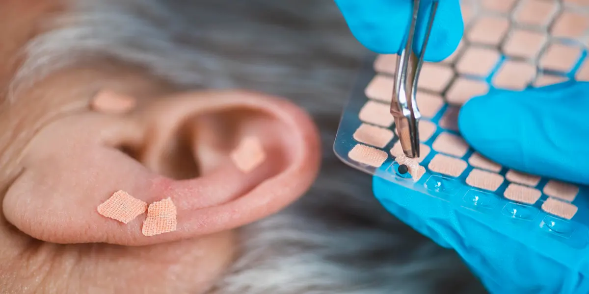 O que é Auriculoterapia: benefícios e princípios